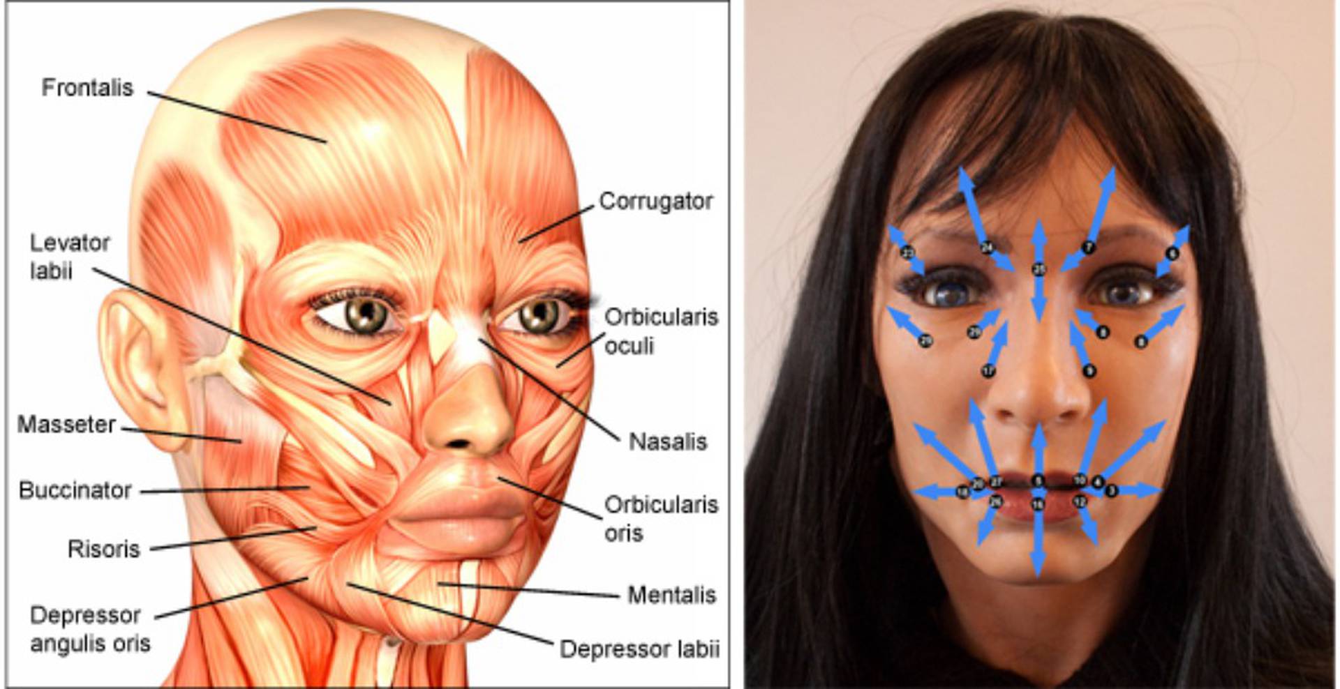 Cushingoid facial features