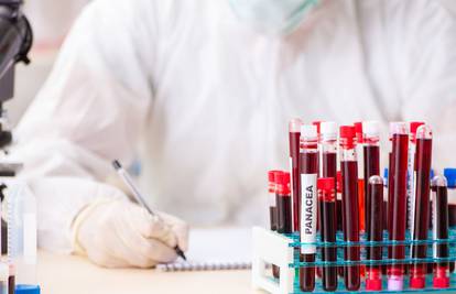 Test krvi mogao bi identificirati milijune ljudi koji nesvjesno šire tuberkulozu: 'Jako smo blizu...'