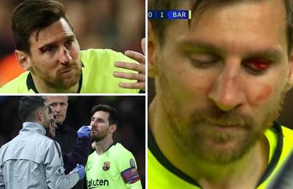 Leo Messi upoznao Smallinga: 'Krvari, znači da je ipak čovjek'