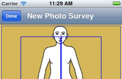 Besplatna aplikacija otkriva rak kože na temelju 23 fotografije 