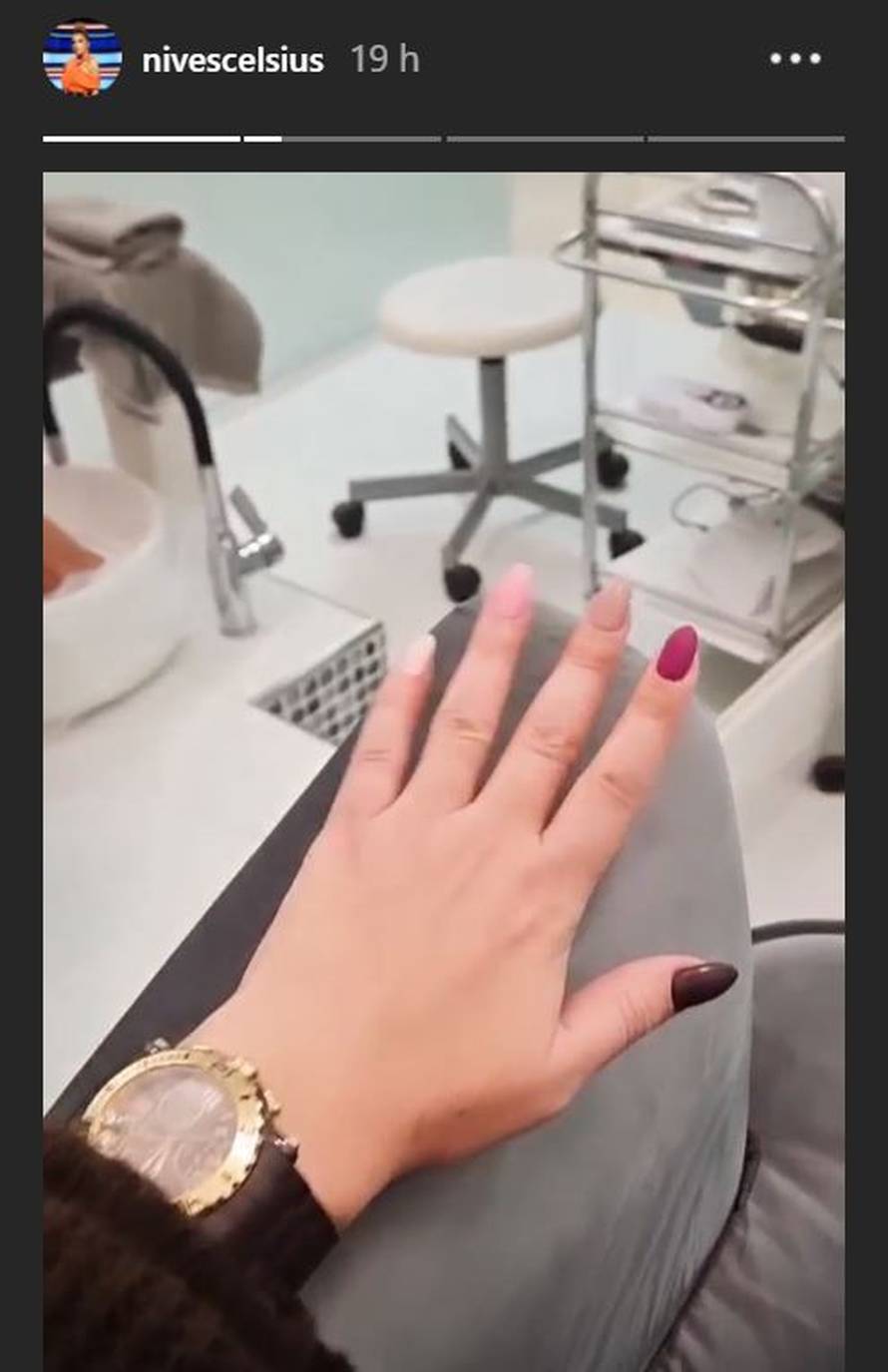 Celzijus sve zbunila s prstenom: Greškom je pokazala zaručnički?