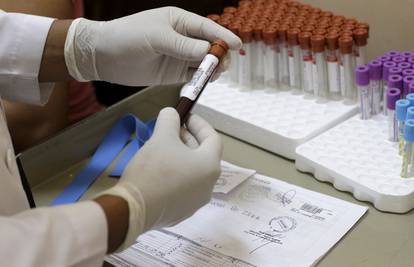 Hrvatica se u Brazilu zarazila zika virusom, ali je ozdravila