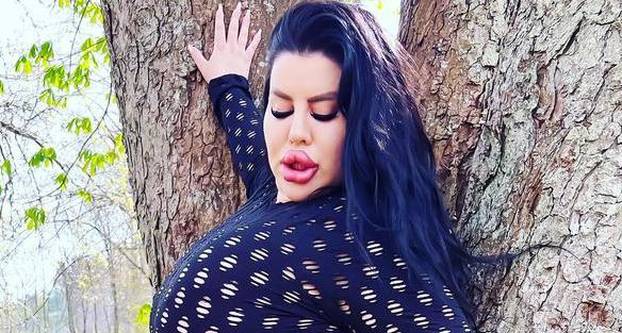 FOTO Stražnjica mi teži 45 kila, no već imam u planu sljedeću operaciju, želim imati najveću!