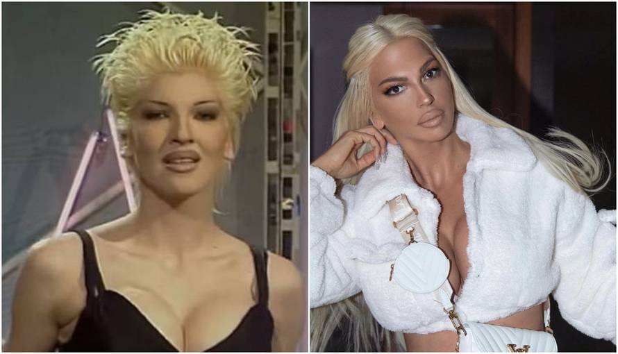 'Svi govore da sam od plastike, a ja sam operirala samo grudi'