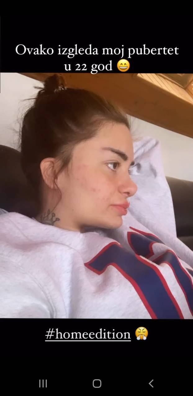 Na kirurga koji je unakazio žene žalila se i Kristina Mandarina. Evo što je njoj operirao...