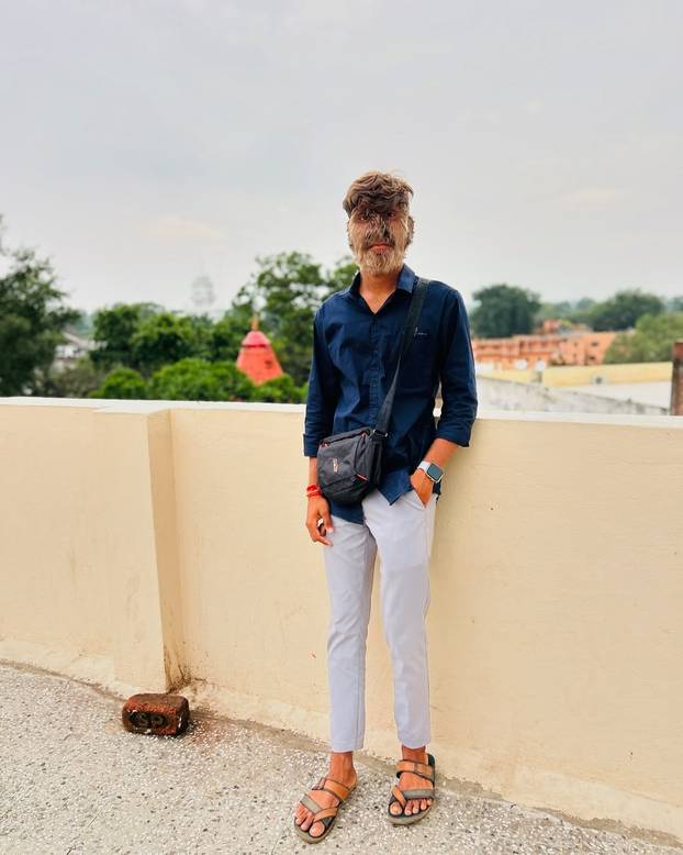 FOTO Ovaj mladić (18) pati od sindroma vukodlaka: U školi me sprdaju, ali volim svoje dlake...