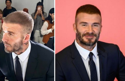 Beckham s gustom, tamnom kosom: Bio na presađivanju?