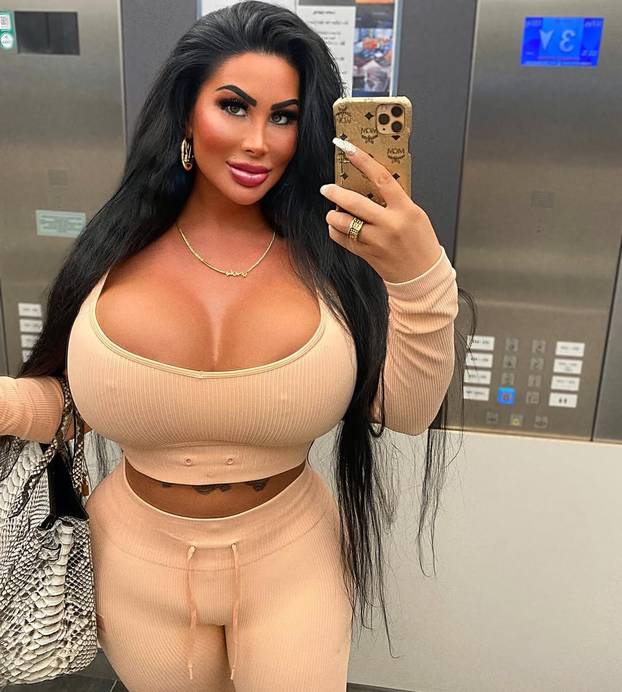 FOTO Barbie iz Berlina pobrala lovu bake pa ulupala 36.000 € u operacije: 'Ja sam umjetnost'