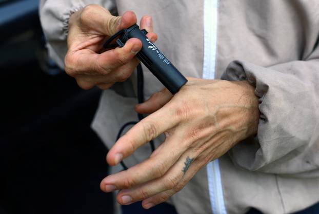 Bee rescuer Clarence Chua removes the stinger and venom of a bee sting using a suction tool at a work site in Singapore