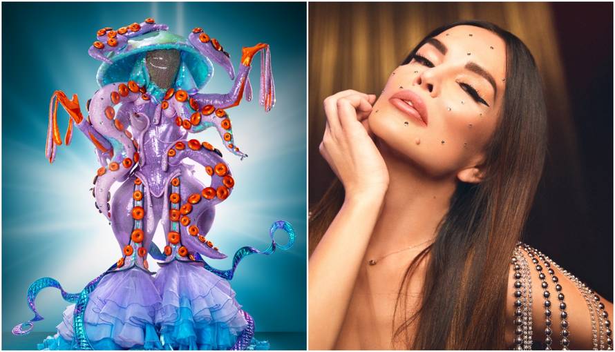 Juraj Zigman: Severinu bih želio ispod svoje maske Meduze...