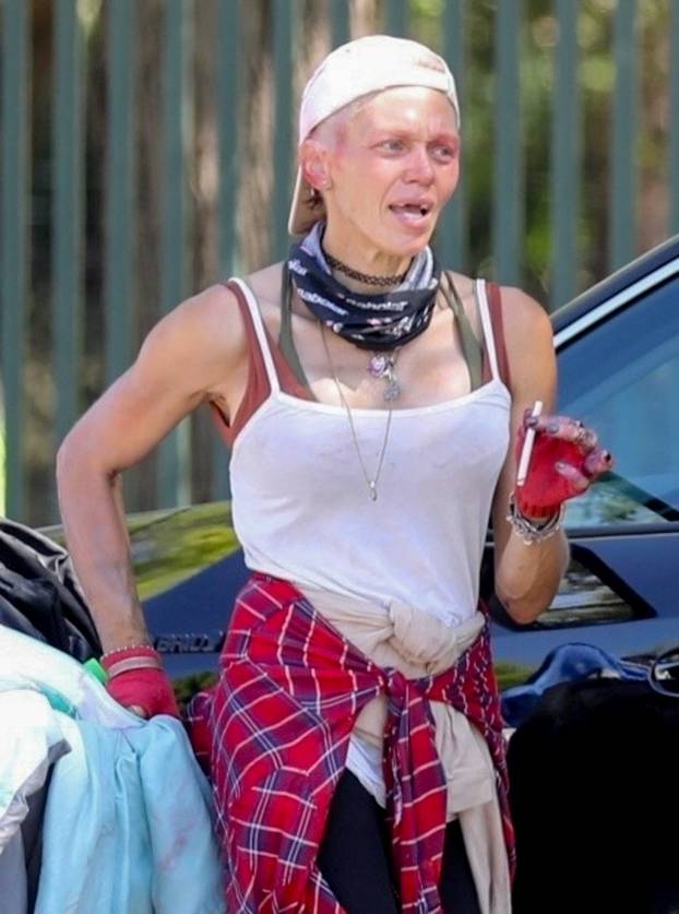 *EXCLUSIVE* Fitness-model-turned-homeless-addict Loni Willison suffers from a bruised red eye in LA
