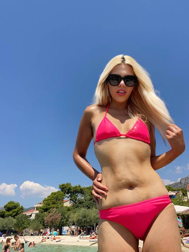 FOTO Missica Antea skinula je 50 kilograma. Pogledajte nevjerojatnu transformaciju