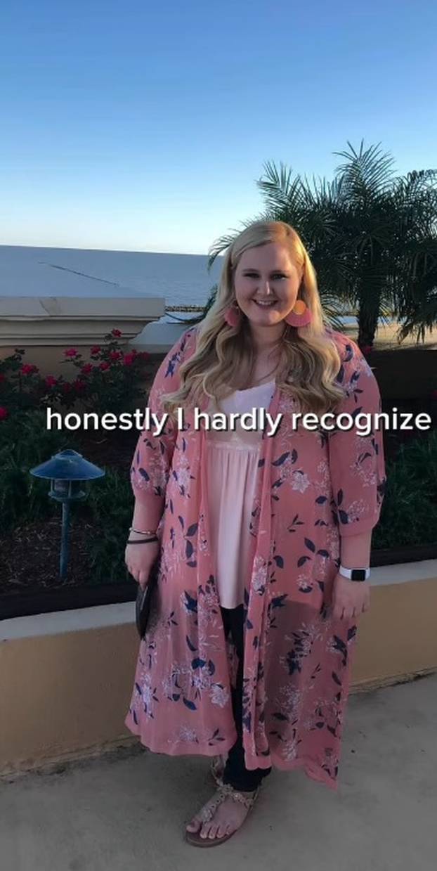 FOTO 'Dečki su me ostavljali zbog moje kilaže. Izgubila sam 80 kg i sad me žele natrag...'