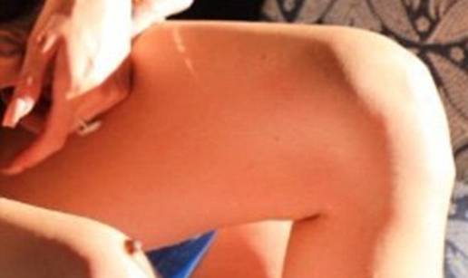 'Photoshop transplantacija': Zar ima bradavicu na koljenu?