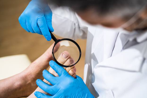 Ingrown,Toenail,Problem.,Infected,Patient,Foot,Check