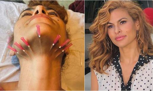 Strše joj igle iz vrata: Eva Mendes na anti-age tretmanu