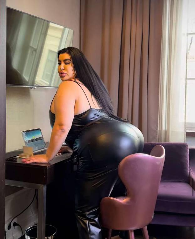 FOTO Stražnjica mi teži 45 kila, no već imam u planu sljedeću operaciju, želim imati najveću!