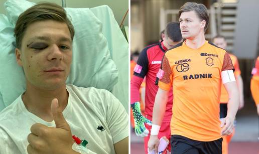 Bivši kapetan Varaždina vratio se s posudbe polomljenog lica