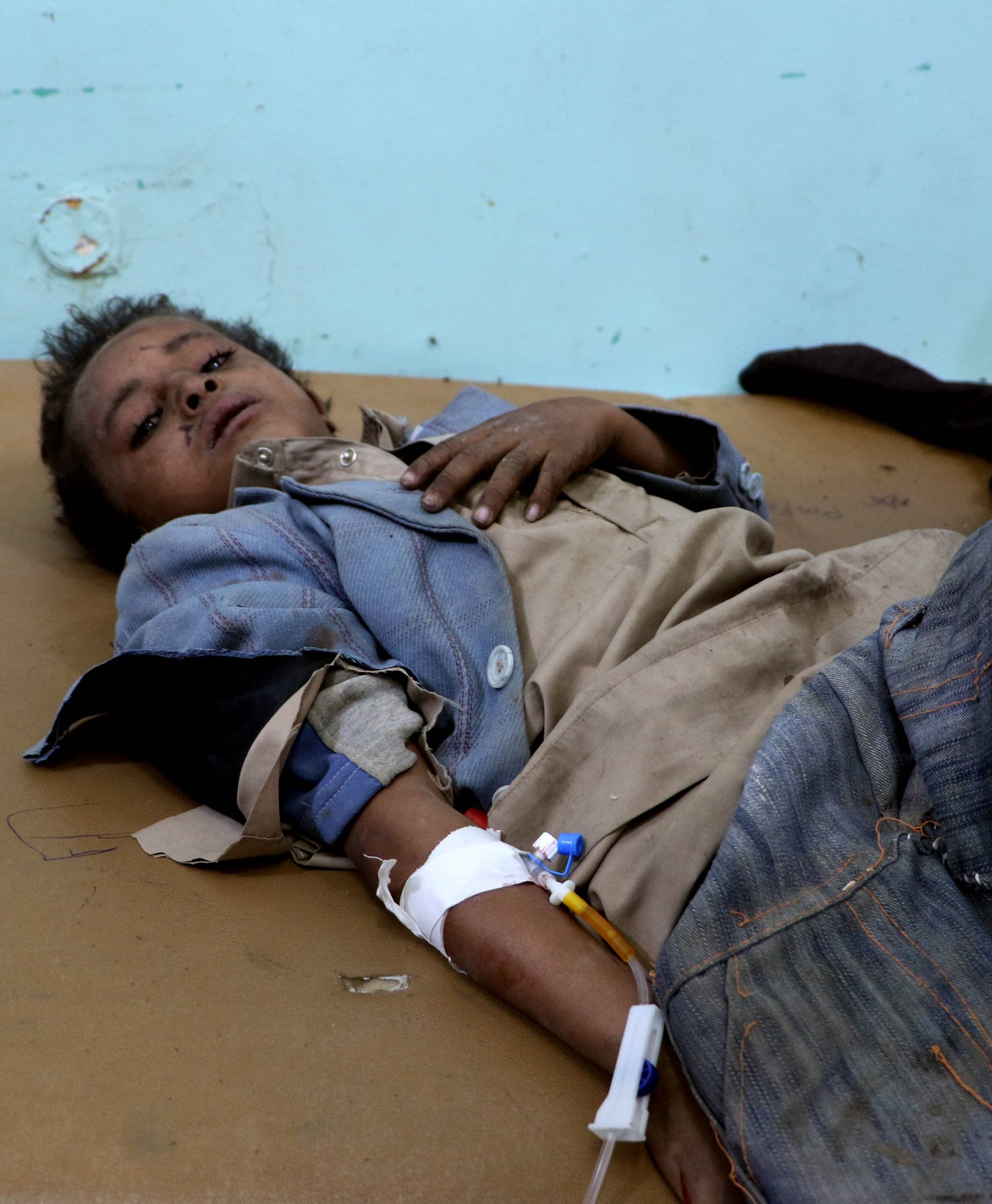 A Yemeni boy lies in the hospital after he was injured by an airstrike in Saada