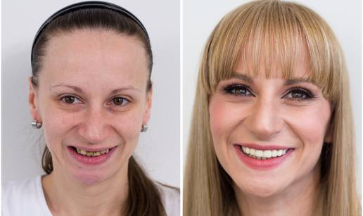 Humanitarni makeover Štimac centra dentalne medicine