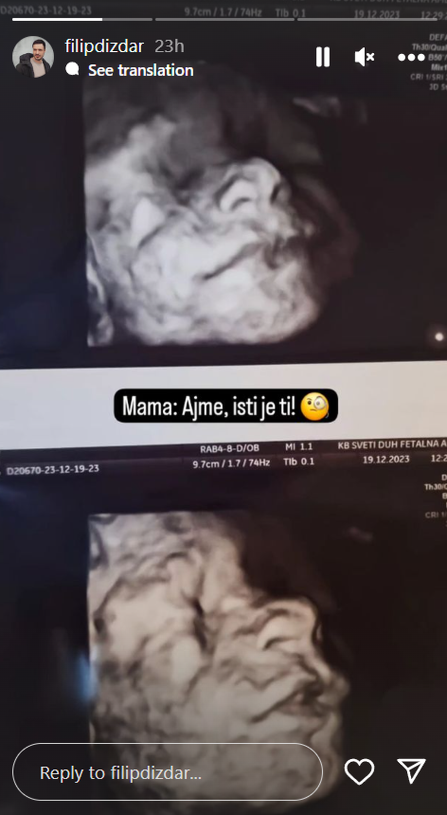 Stiže prinova! Brat Natali Dizdar otkrio: 'Svoj blagdanski poklon moram čekati još tri mjeseca...'