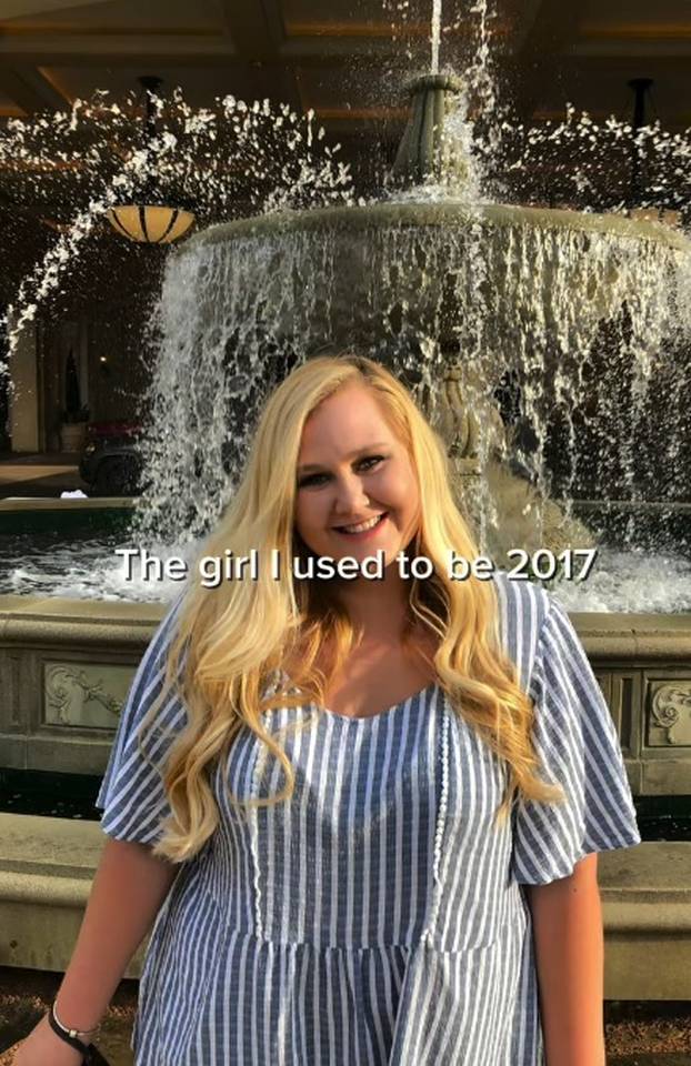 FOTO 'Dečki su me ostavljali zbog moje kilaže. Izgubila sam 80 kg i sad me žele natrag...'