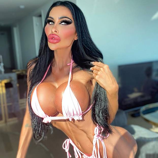 FOTO Potrošila više od 100 tisuća eura kako bi izgledala kao 'ljudska barbika' - Liječnici zgroženi