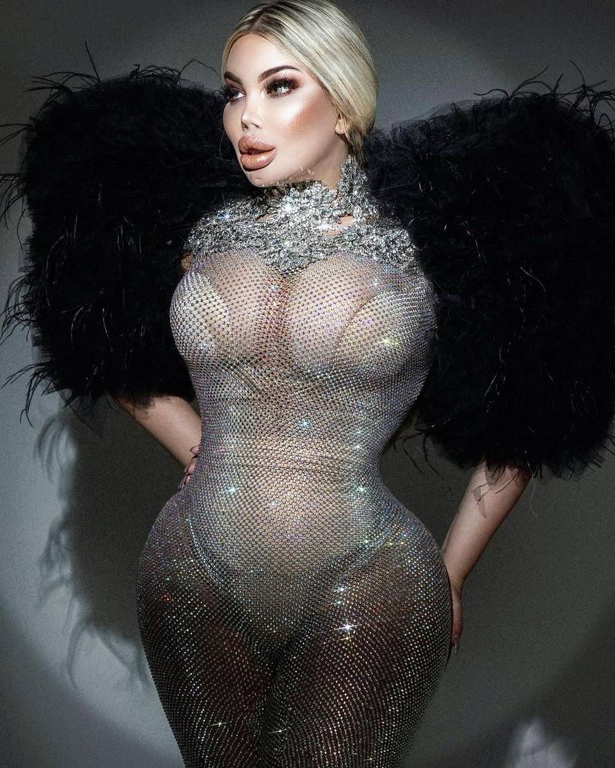 Bivši 'ljudski Ken': 'Muškarci vide da sam transrodna žena. Preplaše se, a nekima je fetiš'