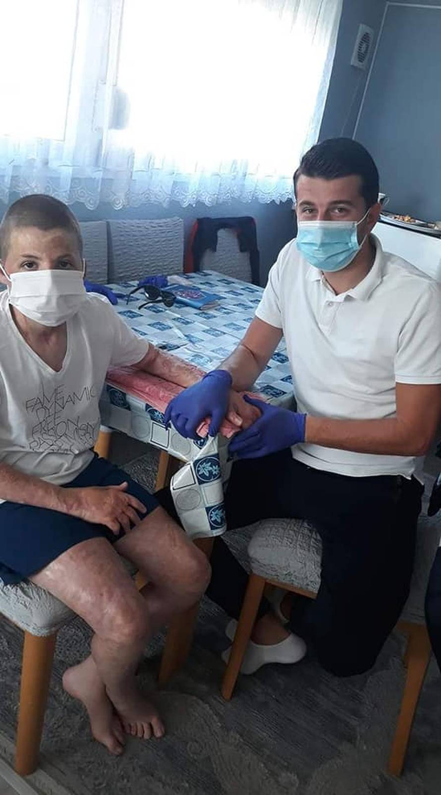 Meho je živ gorio: 'Mogao sam odustati, ali odlučio sam živjeti'