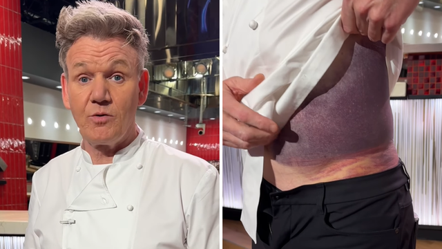 Gordon Ramsay doživio tešku biciklističku nesreću: 'Da nisam nosio kacigu ne bih bio ovdje'