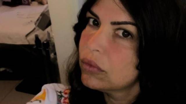 Žena iz Srbije botoksirala je na crno, radila i u Sl. Brodu: 'Meni je spalila lice i uništila zdravlje'