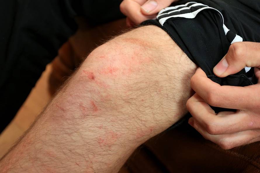 Davor Javorović/Pixsell