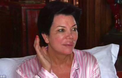 Majka Kim Kardashian u šoku: Što mi se dogodilo s usnicom?