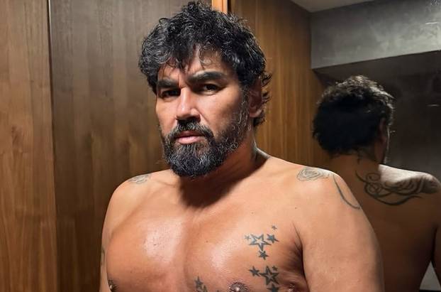 FOTO Ima pjesmu sa Severinom, stavio silikone u prsa, presadio i dlake: Ovako se mijenjao Azis