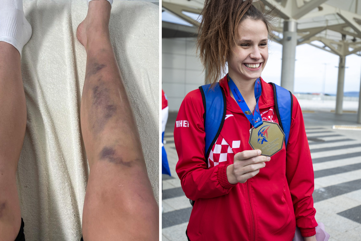 Zlatna Hrvatica: Ponekad nakon borbi ne mogu hodati od bolova