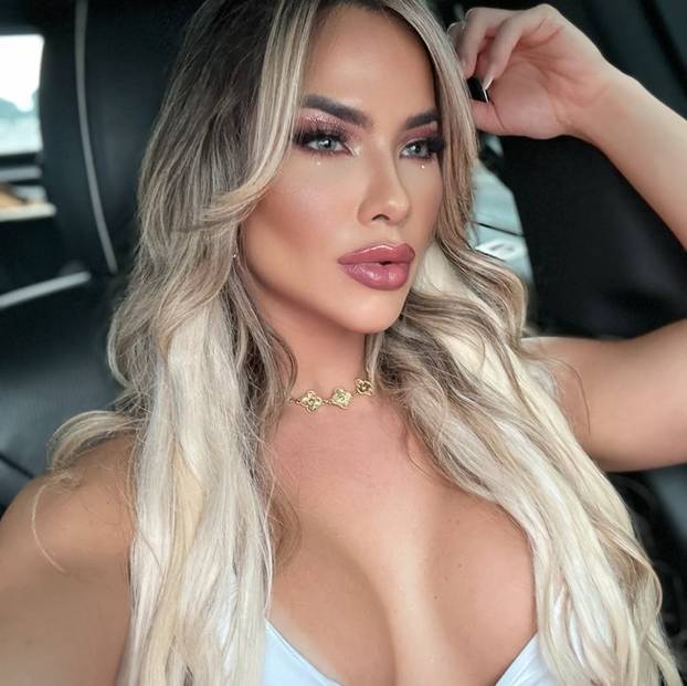 FOTO Nosi nadimak 'guza koja ometa'. Kaže da joj ne smeta: 'Sve prirodno. Nema silikona...'