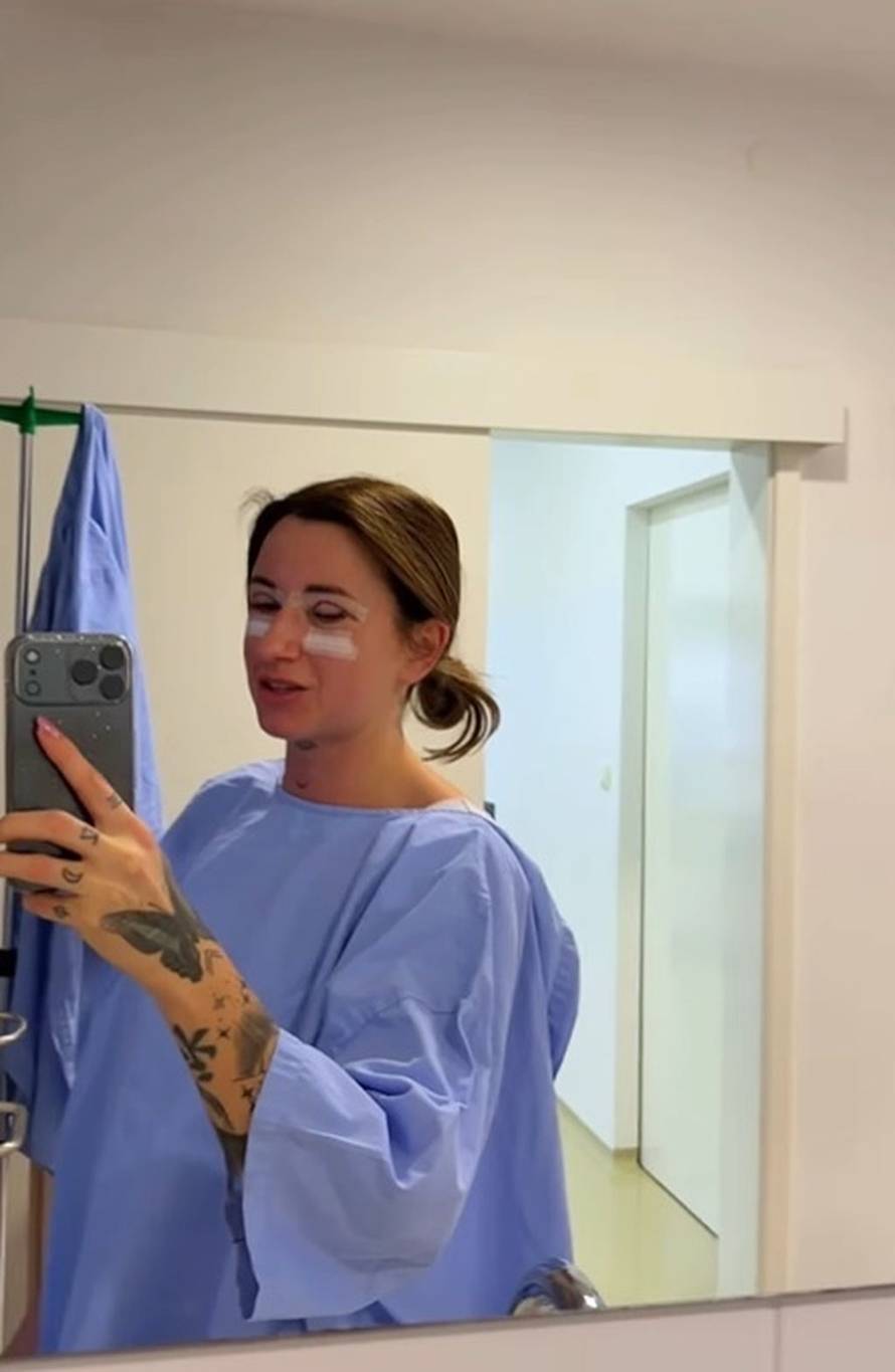 VIDEO Sestra Stele Rade bila je na estetskom zahvatu: 'Možda će vas ovo malo šokirati...'