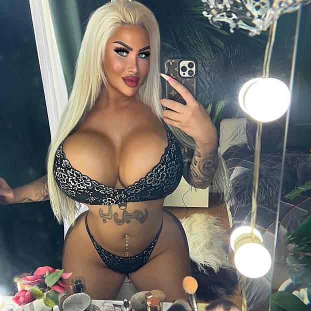 FOTO Barbie iz Berlina pobrala lovu bake pa ulupala 36.000 € u operacije: 'Ja sam umjetnost'