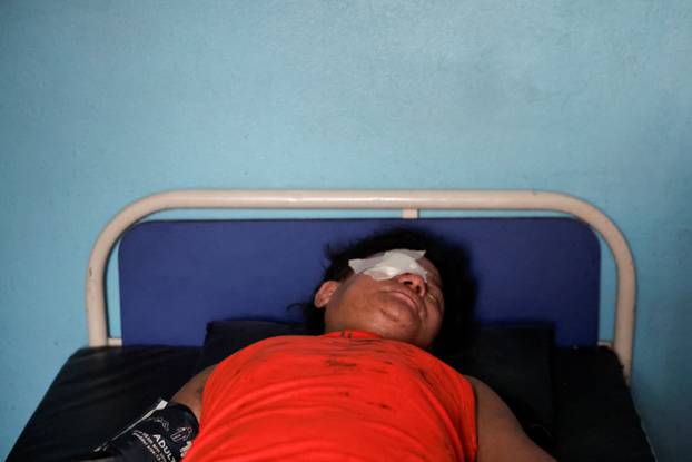 An injured man lies in a hospital bed for treatment following a flash flood at Trishuli, Nepal