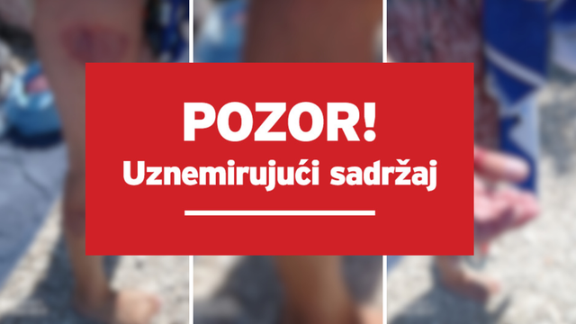 Novi napad kornjače na Čiovu: 'Agresivno je plivala, žena je u šoku, cijela noga joj je krvava'