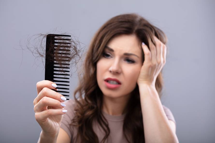Worried Woman Suffering From Hairloss