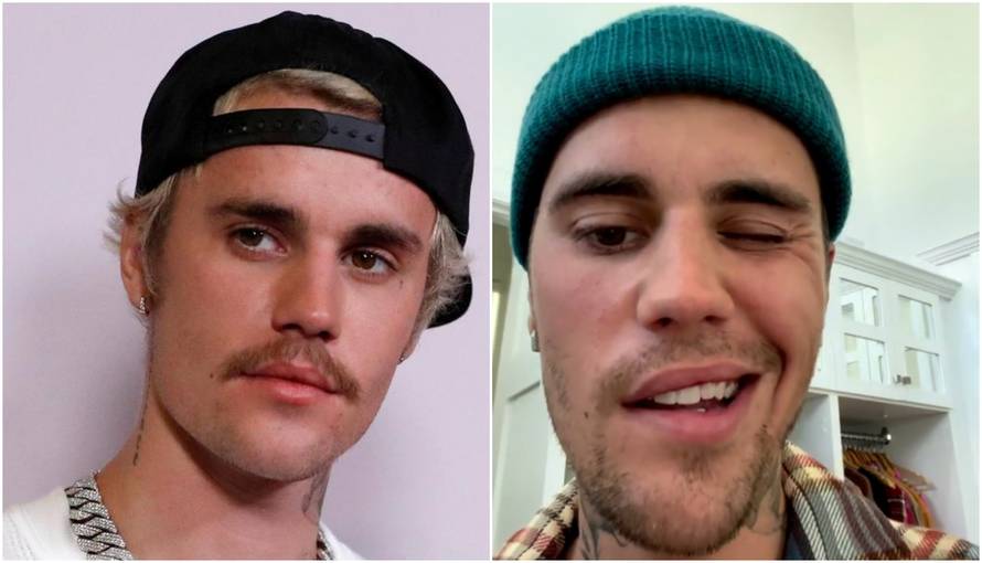 Bieber se nakon paralize lica povukao, ali sad se vraća glazbi