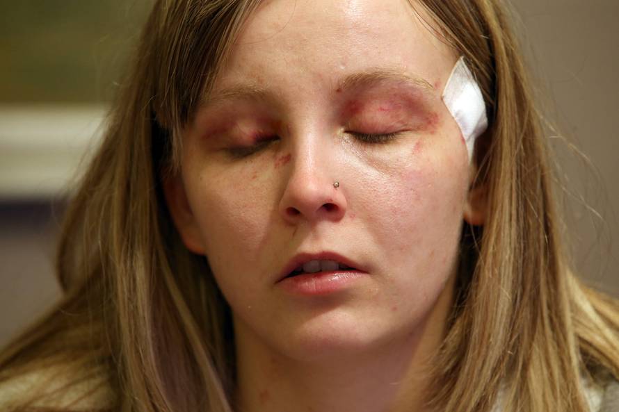 Pretukao sestre: Nasilniku su odredili pritvor do 15 dana