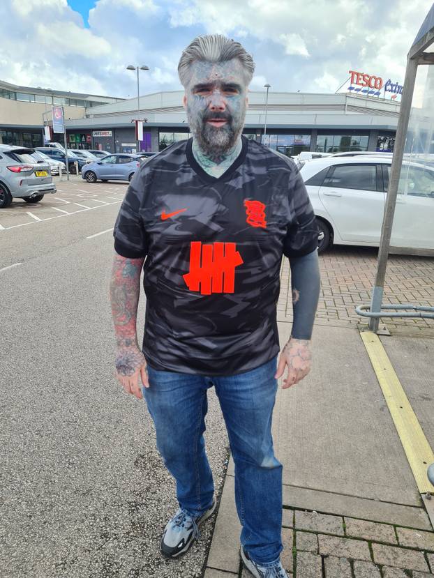 FOTO Više mu ne stane nijedna tetovaža! Uklonio je i bradavice. Evo kako je prije izgledao: Wow