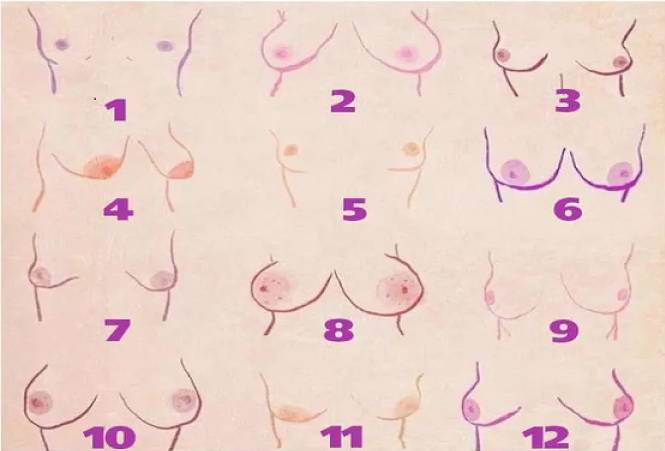12 je tipova ženskih grudi - a svaki govori o osobnosti