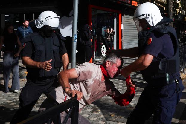 Albanian students hold anti-government protest