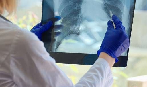 Ova bolest svake minute ubije dva čovjeka!  Po broju umrlih nadmašila je i koronavirus