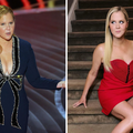 Amy Schumer otkrila tešku pozadinu gubitka kilograma: 'Lice mi se vratilo u normalu...'