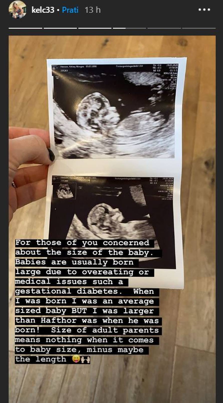 Thor i žena čekaju dijete: Na fotki ultrazvuka beba drži uteg