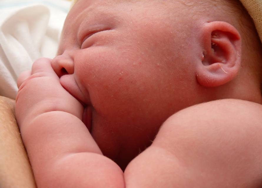 Teže bebe sklonije su kožnim ekcemima, alergijama na hranu